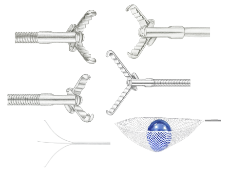 02 Pinzas de extracción